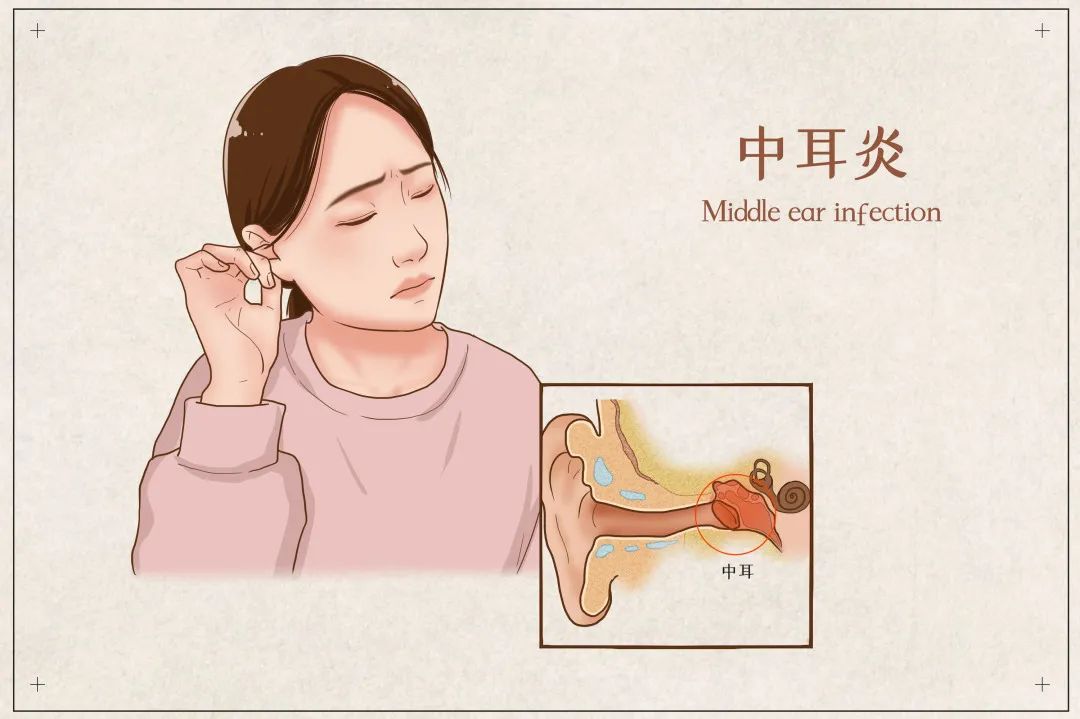 得了中耳炎吃点药就能好吗